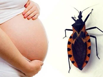 Resultado de imagen para Enfermedad de Chagas: la transmisiÃ³n materna